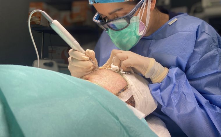 Entrevista Trasplante Capilar 2ª Parte